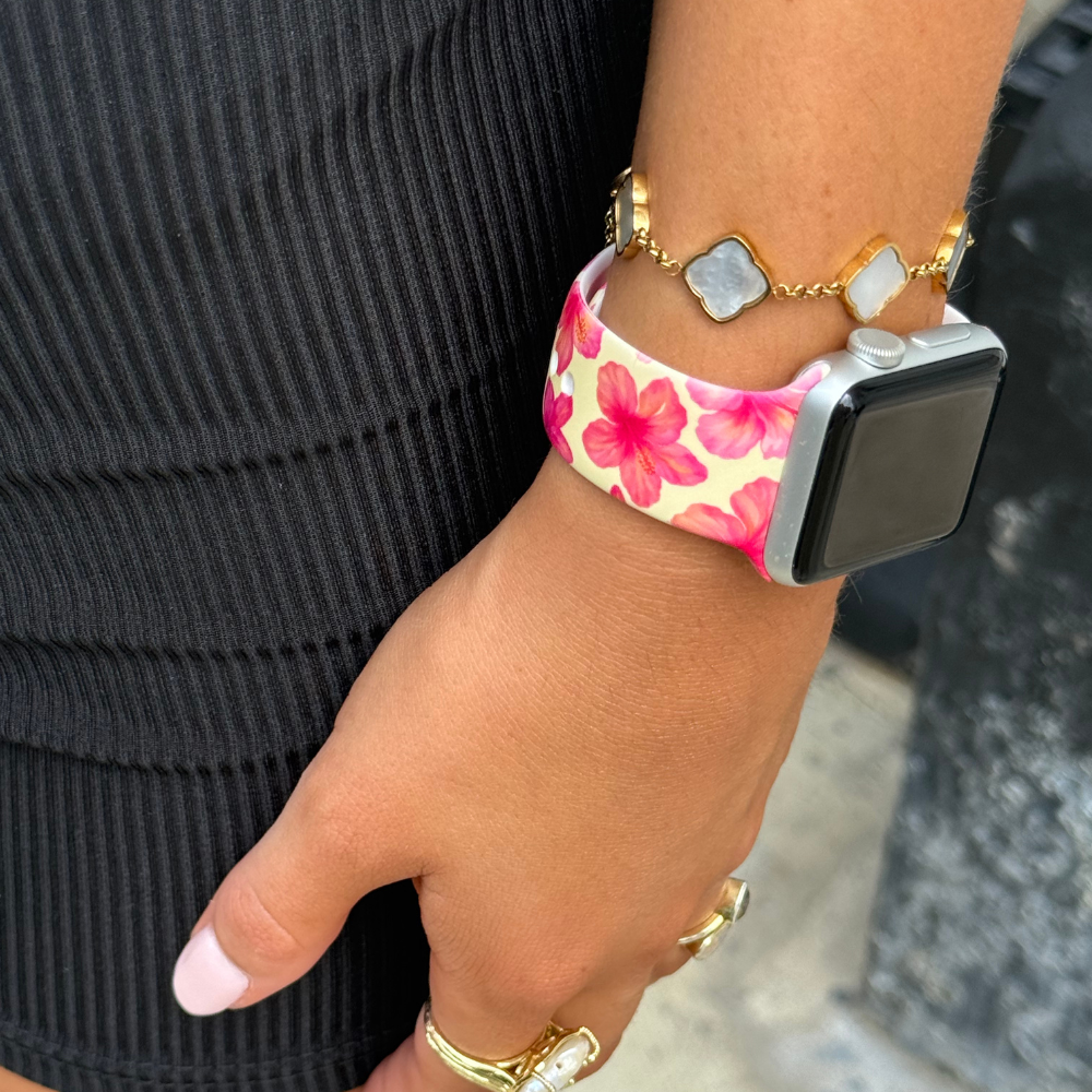 Ada Kızı Tereyağı Sarısı Hibiskus Apple Watch Kayışı